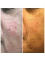 Luméra Triple Power Hydration & Skin Barrier Repair Serum - Image 3