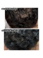 ClariScalp - Image 3