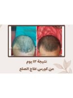 Hair Growth Course - Image 30