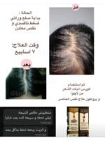 Hair Growth Course - Image 57