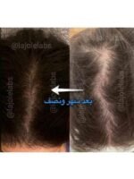 Hair Growth Course - Image 62