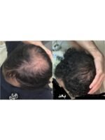 Hair Growth Course - Image 71
