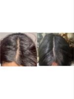 Hair Growth Course - Image 70