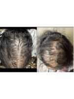 Hair Growth Course - Image 63