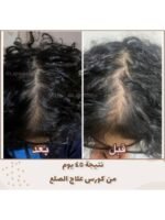 Hair Growth Course - Image 72