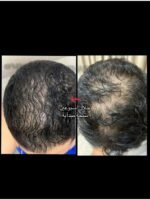 Hair Growth Course - Image 52