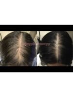 Hair Growth Course - Image 59