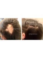 Hair Growth Course - Image 64