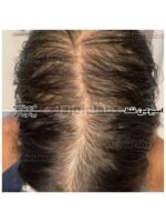 Hair Growth Course - Image 74