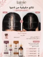 Hair Growth Course - Image 77