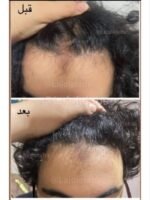 Hair Growth Course - Image 73