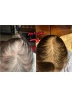 Hair Growth Course - Image 75