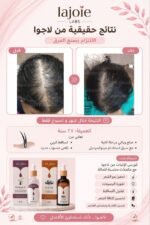 Hair Growth Course - Image 78