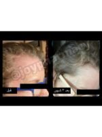 Hair Growth Course - Image 61