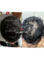 Hair Growth Course - Image 53