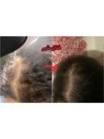 Hair Growth Course - Image 65