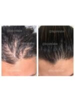Hair Growth Course - Image 66