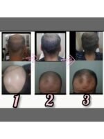 Hair Growth Course - Image 67