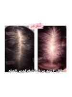 Hair Growth Course - Image 68