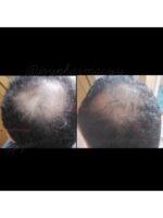 Hair Growth Course - Image 69