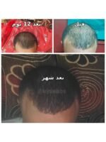 Hair Growth Course - Image 33