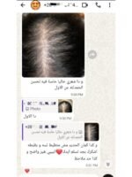 Hair Growth Course - Image 37