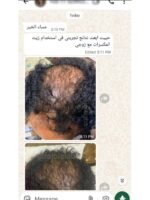 Hair Growth Course - Image 38
