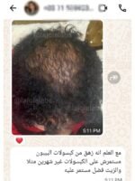Hair Growth Course - Image 39