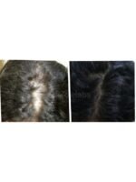 Hair Growth Course - Image 27