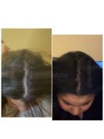 Hair Growth Course - Image 29