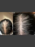 Hair Growth Course - Image 36