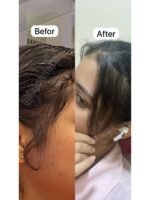 Hair Growth Course - Image 19