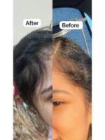 Hair Growth Course - Image 12