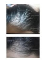 Hair Growth Course - Image 3